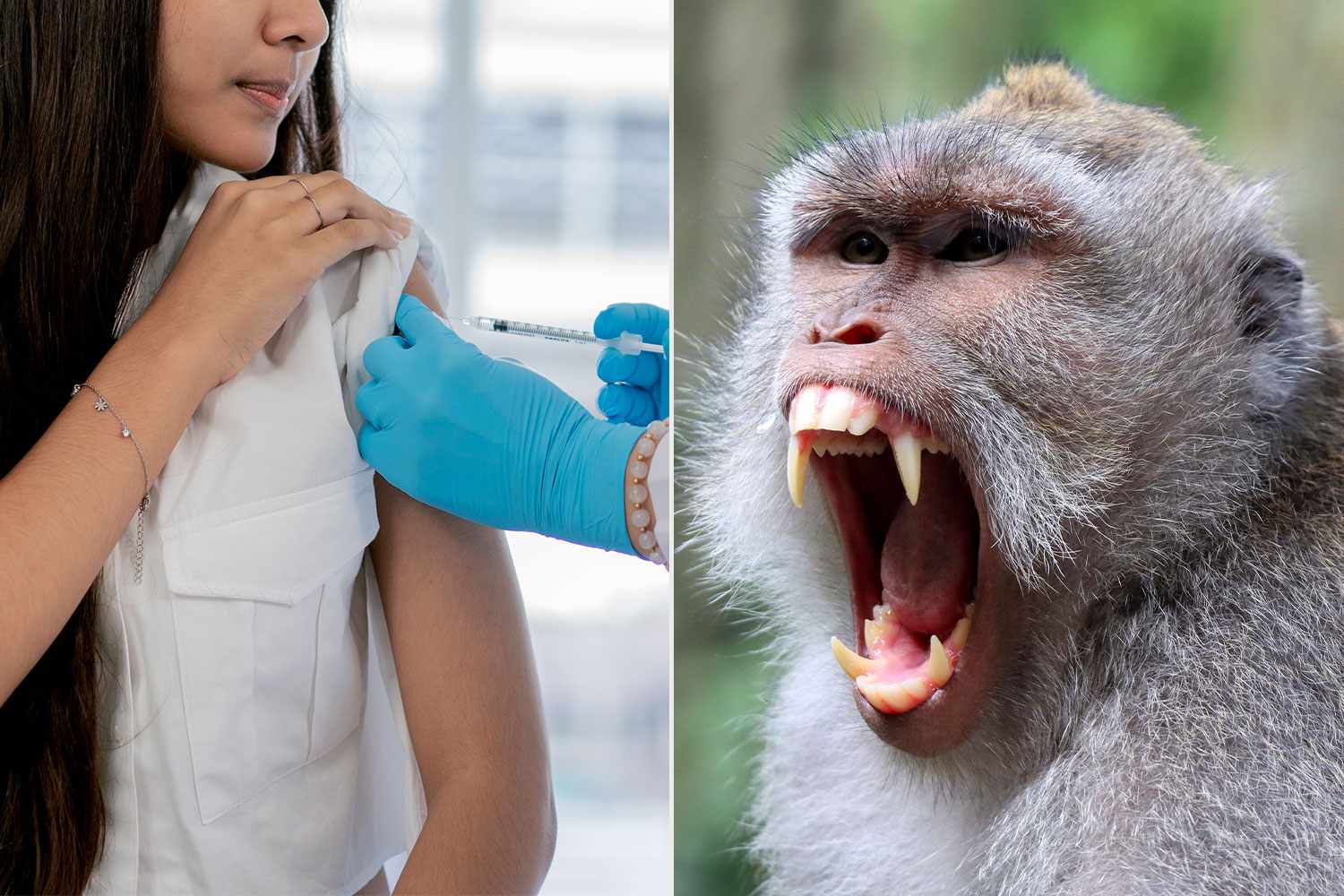 12-Year-Old Gets Rabies Vaccine After Monkey Attack at Popular Park