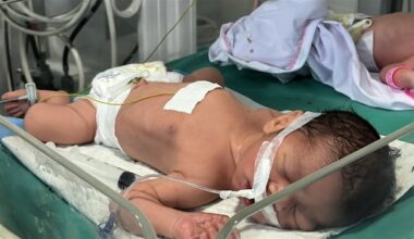 Doctors save unborn baby in Gaza City after mother, father killed in Israeli strike