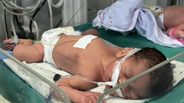Doctors save unborn baby in Gaza City after mother, father killed in Israeli strike