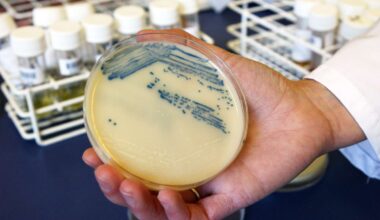 Deadly Drug-Resistant Fungus Is Sweeping Through Hospitals