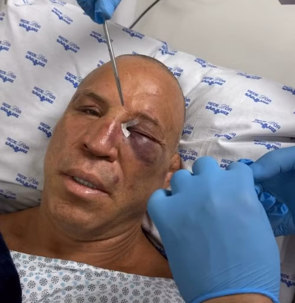 Wanderlei Silva’s post-fight attacker identified as opponent’s son, fighters react to wild knockout