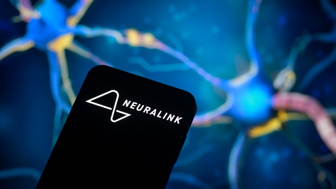 Neuralink Has a Huge Patient Waitlist. Bring on the Robot Surgeons