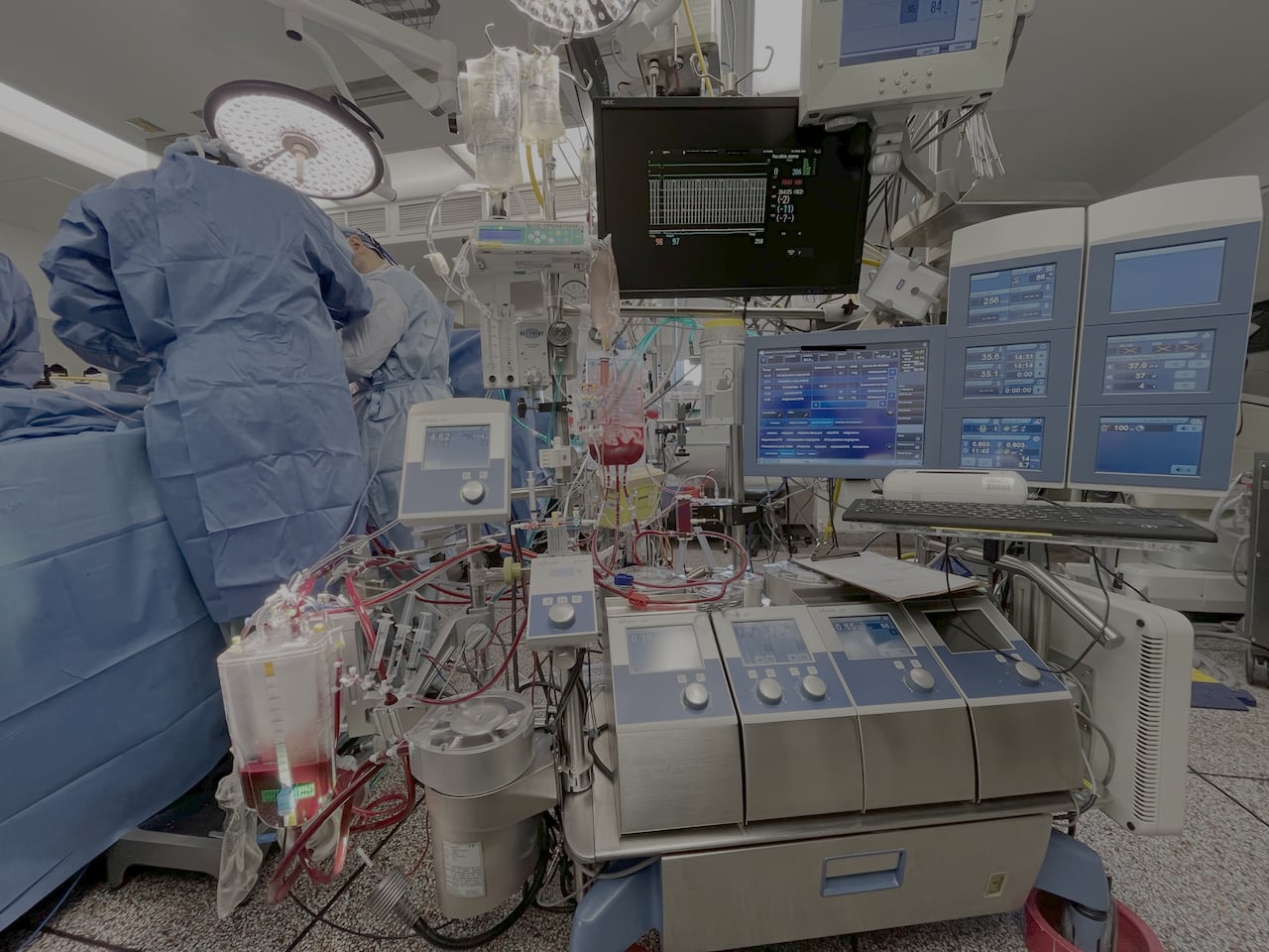 A heart-lung machine is shown during a surgery in an operating room 