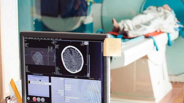 Alberta government plans to allow residents to privately pay for any diagnostic or screening service