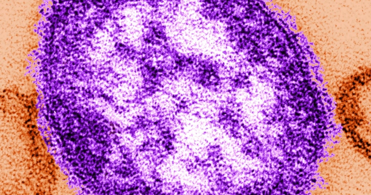 Alberta baby dies from measles - CTV News