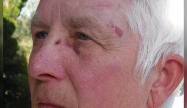 RCMP investigate alleged assault of woman who lives beside B.C. ostrich farm - CTV News