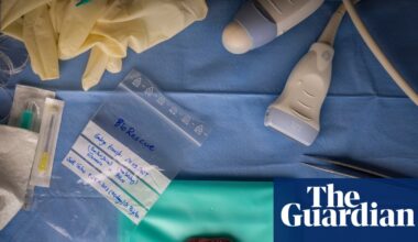 A tiny rhino foetus developed by IVF: Jon A Juárez’s best photograph | Photography