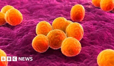 The Berkshire hospital washing its hands of sinks