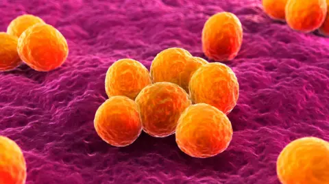 Getty Images MRSA bacteria. Computer artwork of methicillin-resistant Staphylococcus aureus (MRSA) bacteria.