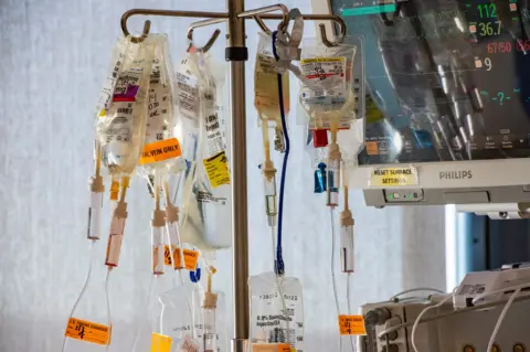 AFP via Getty Images IVs in the ICU ward at an American hospital