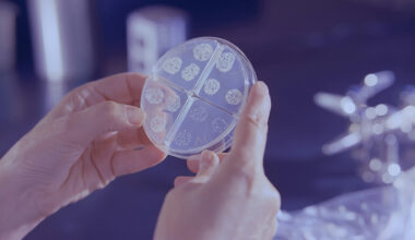 petri dish with several colonies growing