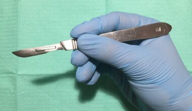 Male circumcision is made easier by a clever South African invention