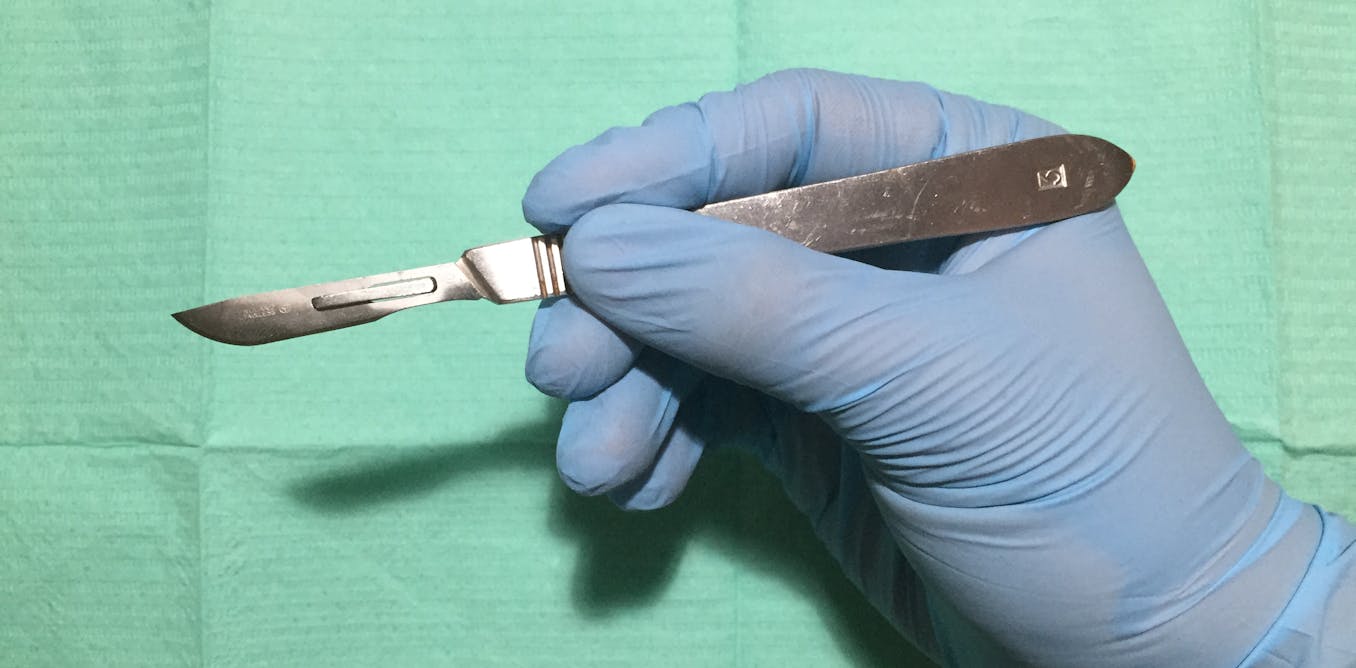Male circumcision is made easier by a clever South African invention