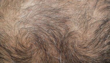 Scientists Found This Natural Sweetener Could Help Regrow Your Hair