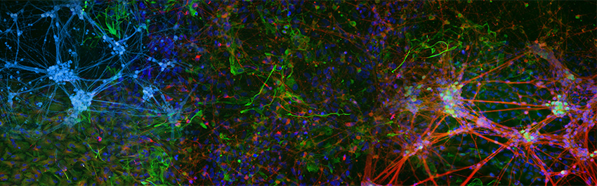 The Worldfolio: Stem Cell Stories: More Than Just Labs