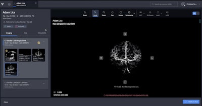 Viz 3D CTA automatically converts CT angiography scans into high-resolution AI-enhanced 3D images.