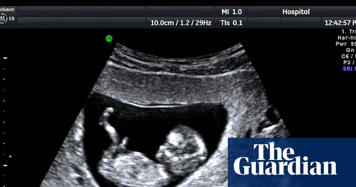 UK’s unregulated pregnancy scan clinics putting lives in danger, say experts | Health