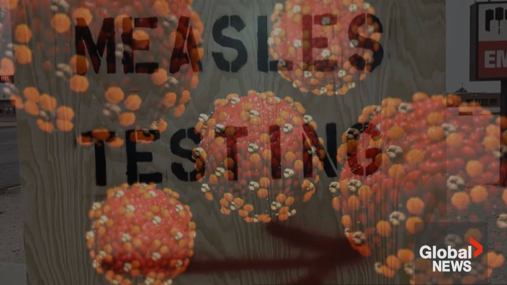 Click to play video: 'Canada could soon lose status as measles-free country, Public Health Ontario says'