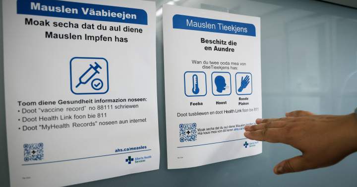 Canada can regain its measles elimination status. Here’s how - National