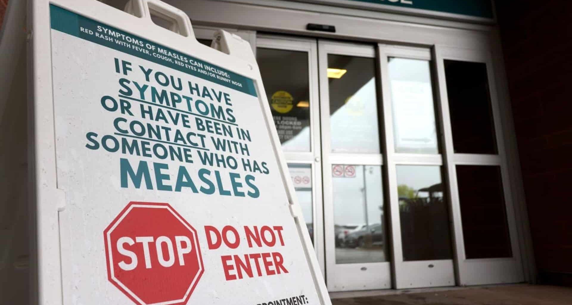 There has been an outbreak of measles in B.C. in 2025. (THE CANADIAN PRESS/Nicole Osborne)