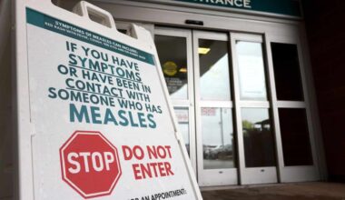 There has been an outbreak of measles in B.C. in 2025. (THE CANADIAN PRESS/Nicole Osborne)