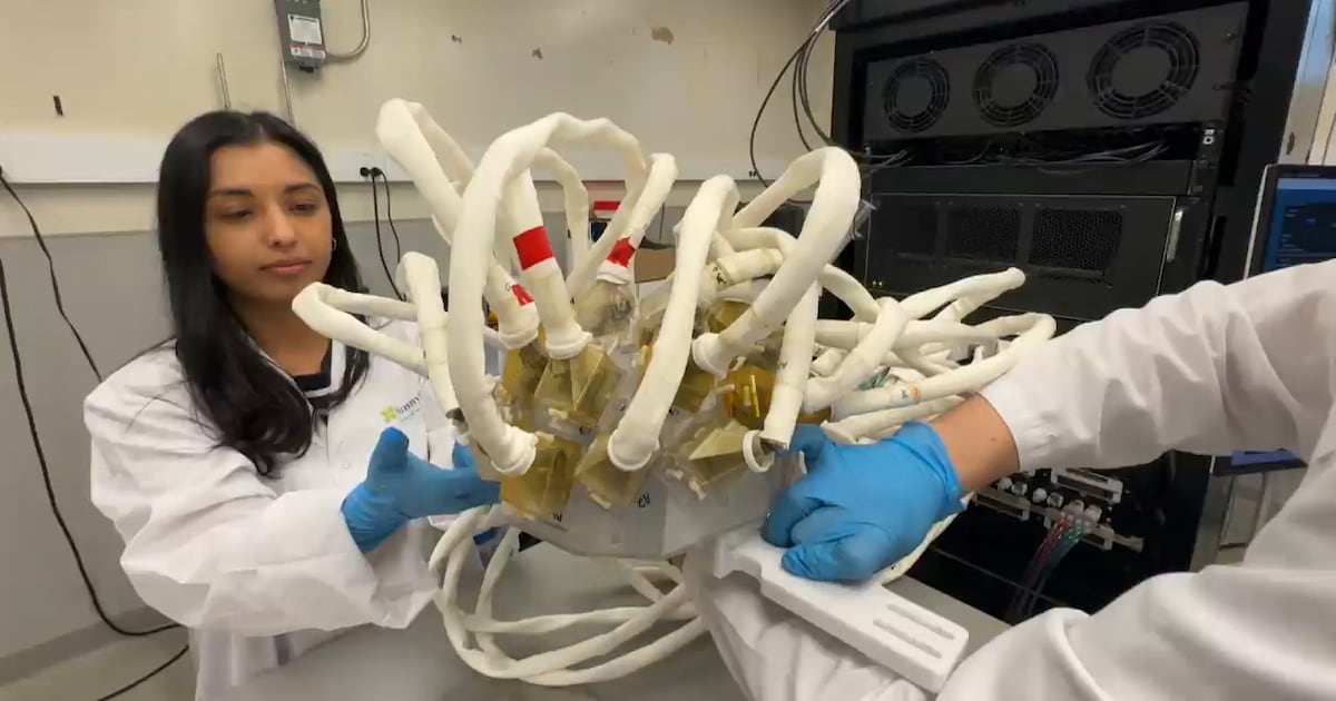 Canadian scientist have brain tumour treatment breakthrough