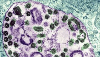 Ethiopia confirms outbreak of deadly Marbug virus: Africa CDC - CTV News