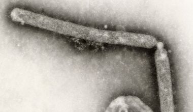 Strain of bird flu virus never before reported in people is behind first human case in U.S. in nine months - CTV News