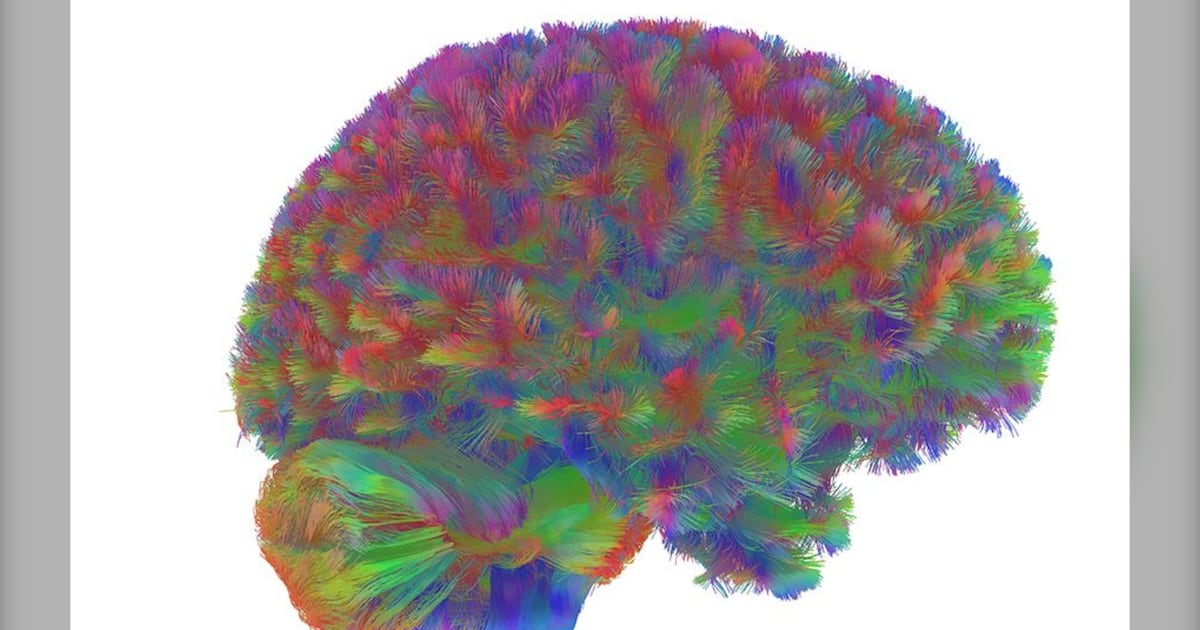 Human brains have five distinct phases, with adolescence lasting until our early 30s: study - CTV News