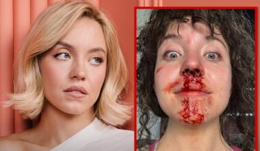 Sydney Sweeney Had Concussions and Bloody Noses While Filming 'Christy'