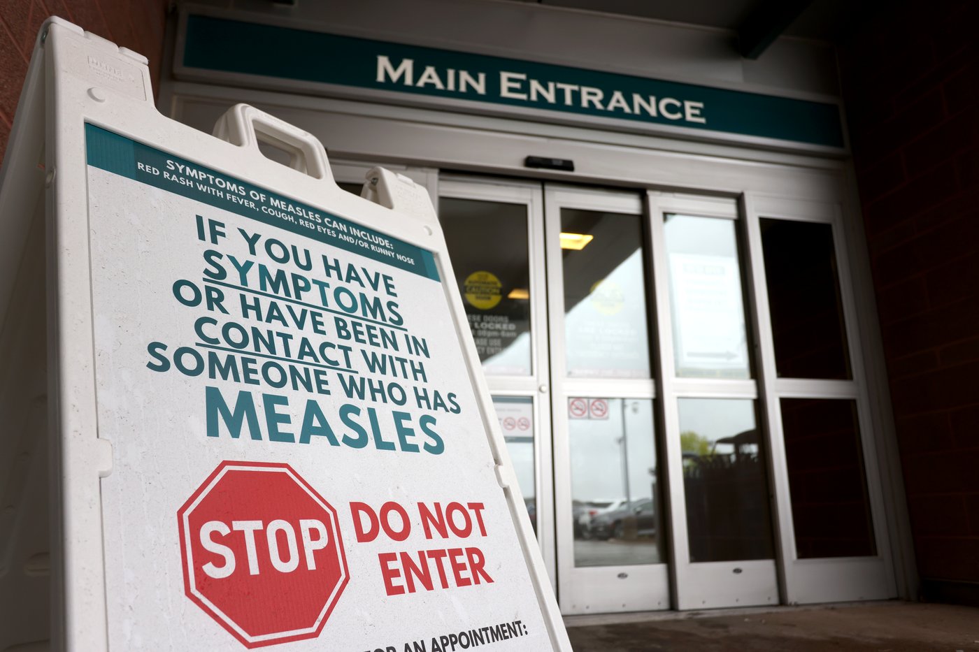 Canada has lost its measles elimination status after more than 25 years
