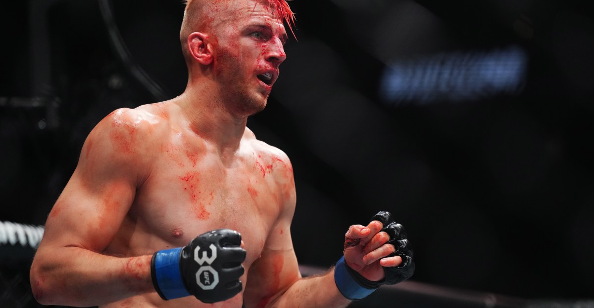 Dan Hooker chips tooth ahead of UFC Qatar main event