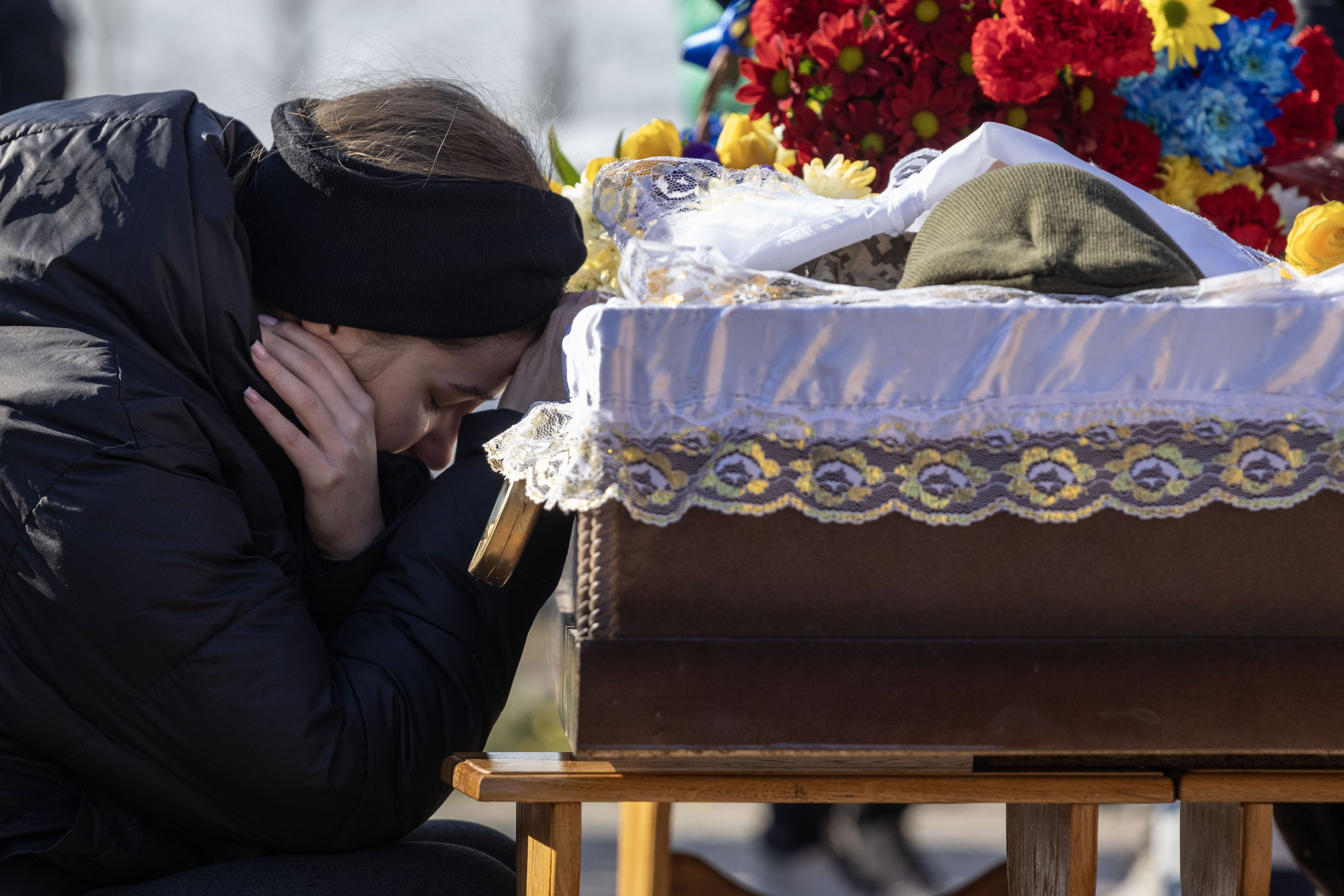 Andrii Onopriienko holding a facial prosthetic that replaces his injured eye.