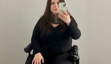 Ontario refuses to help woman with rare disorder that leaves skull detached from spine