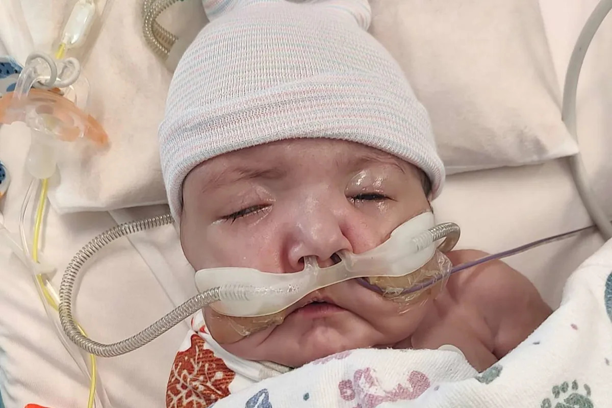 Parents Welcome ‘Miracle’ Baby After 3 Years of Infertility. 4 Months Later, He Dies from Rare Disorder