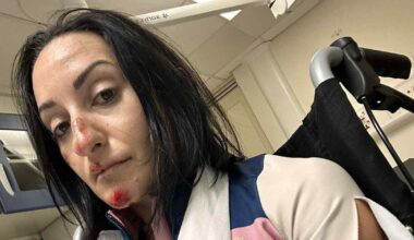 Triathlete breaks collarbone after double speed bump catapults her off bike