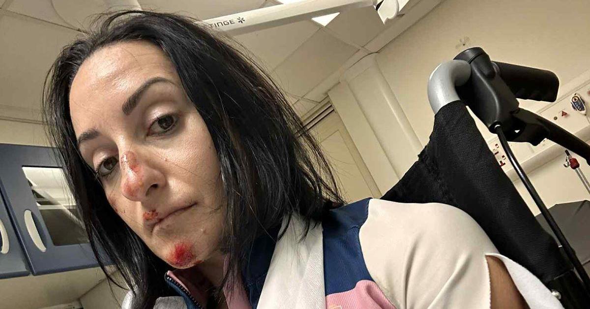 Triathlete breaks collarbone after double speed bump catapults her off bike