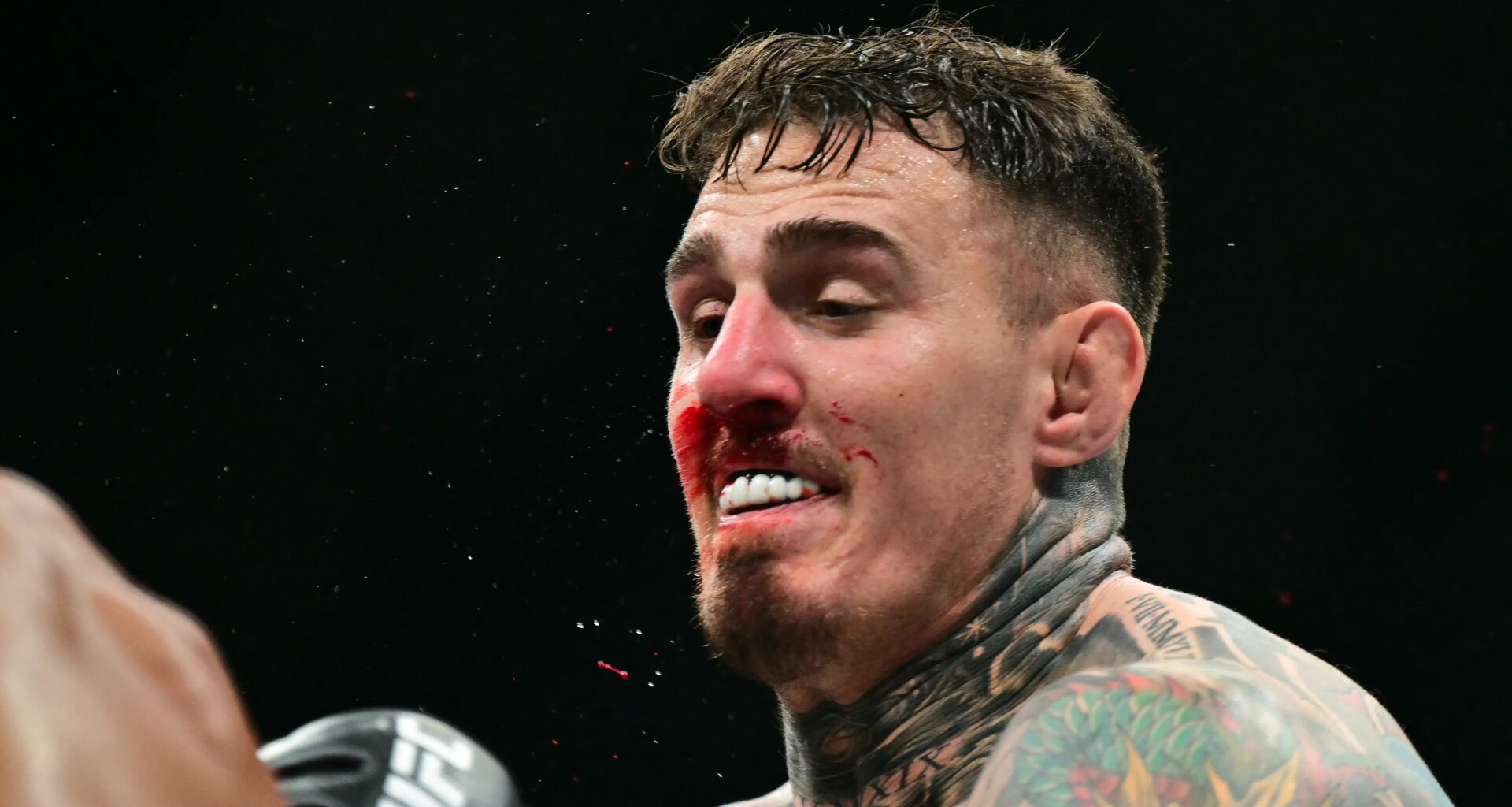 UFC champ Tom Aspinall moving forward with double eye surgery