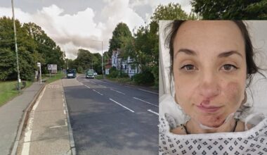 “Most drivers don’t know the rules”: Cyclist left with broken jaw as close passing motorist forces her into pothole before fleeing scene
