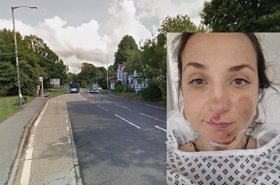“Most drivers don’t know the rules”: Cyclist left with broken jaw as close passing motorist forces her into pothole before fleeing scene