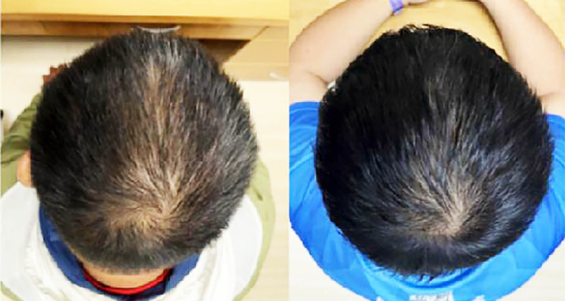 New plant-based serum shown to regrow hair in weeks
