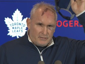 Toronto Maple Leafs coach Craig Berube suffered an injury while working out at the gym.
