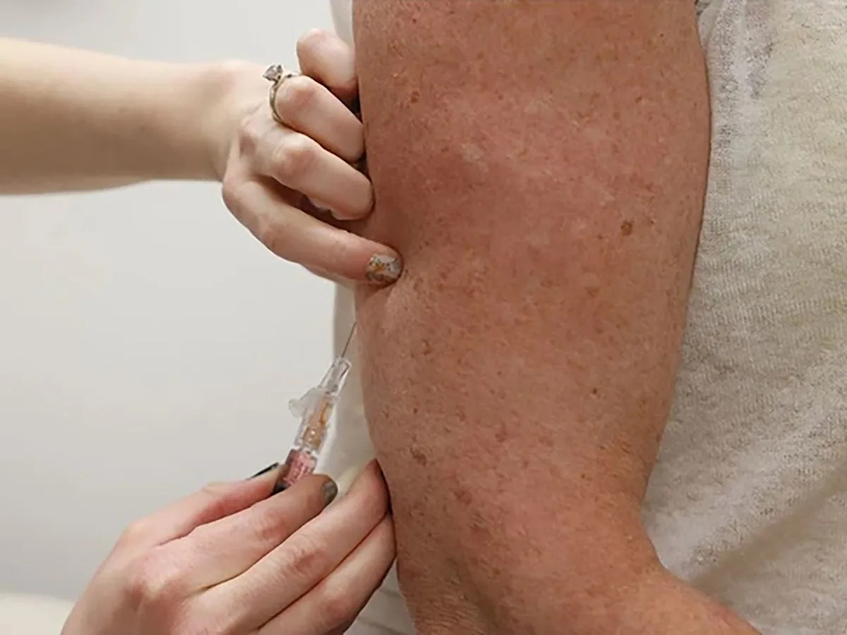 Quebec's measles numbers grow, with 11 confirmed cases