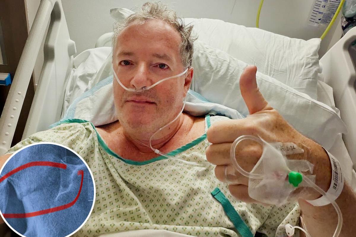 Piers Morgan, 60, hospitalized, will undergo hip replacement