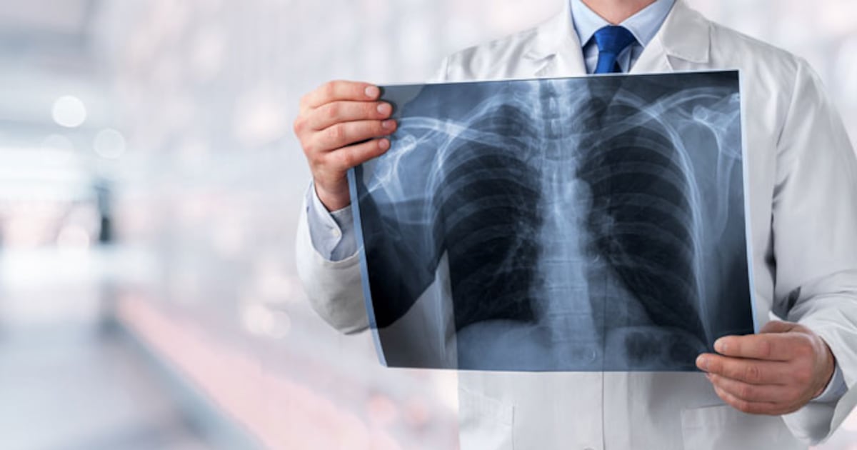 Deaths in Canada due to pneumonia rose by 20 per cent in 2024