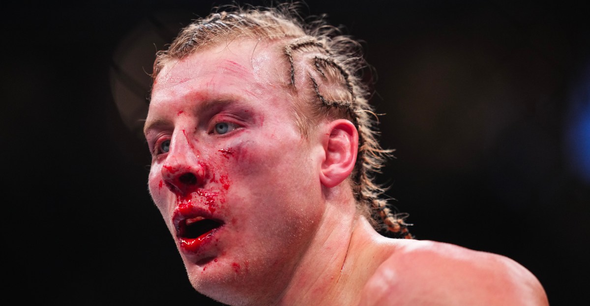 Dana White shares gnarly photo of Paddy Pimblett’s face after UFC 324