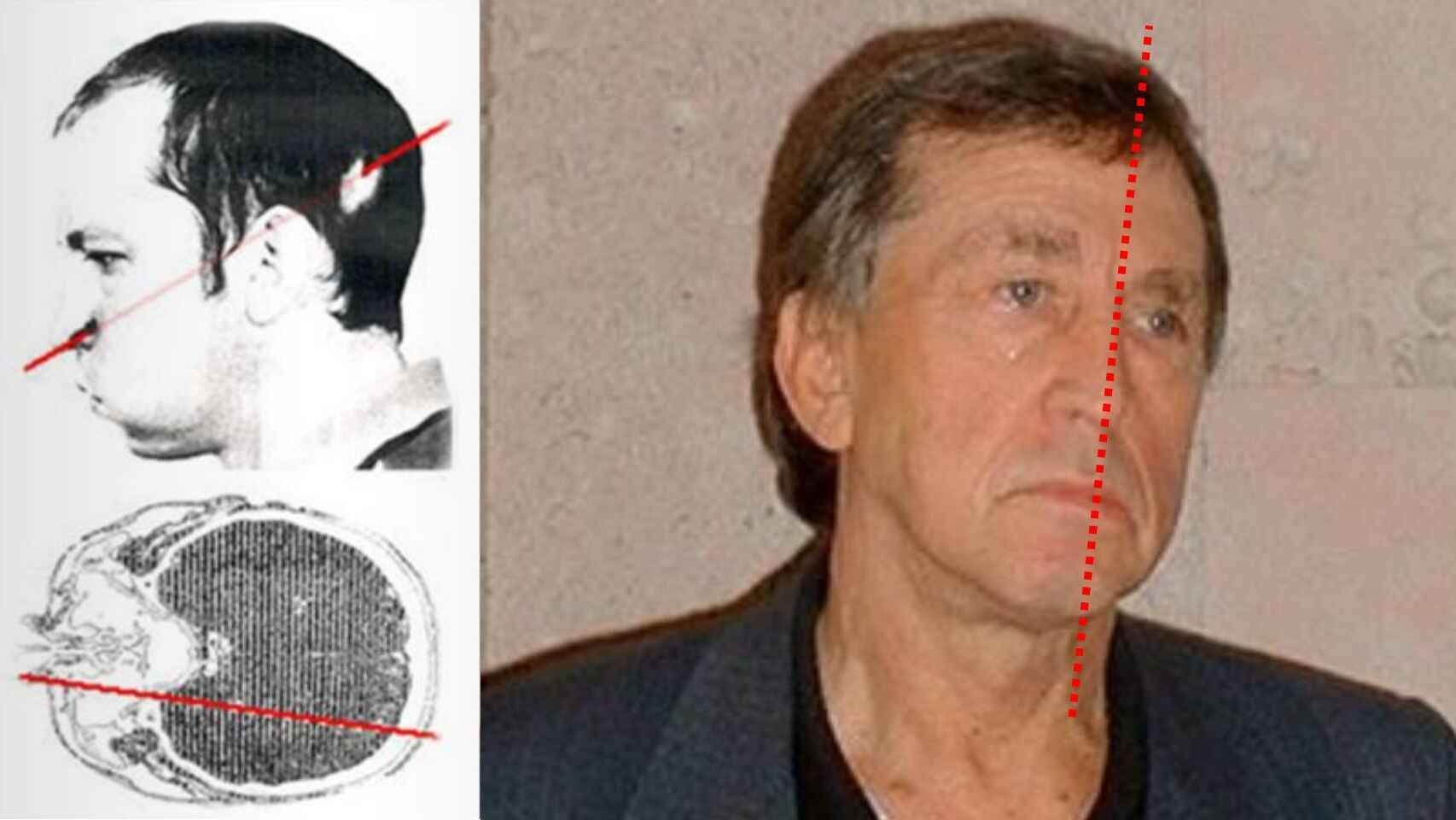 A man with facial asymmetry is shown next to medical diagrams, a red dashed line indicating the angle of his facial structure—possibly highlighting damage from cosmic ray exposure on the human face.