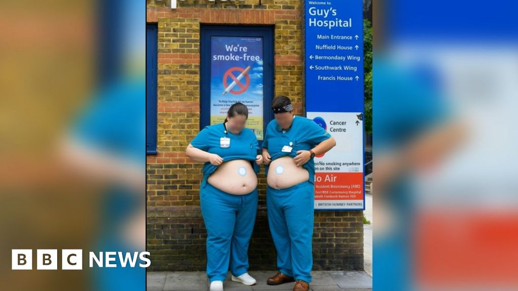 Weight loss videos using AI doctors prompts hospital warning
