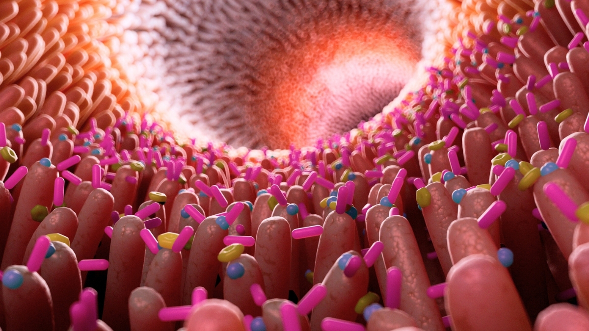 Gut Inflammation Link to Alzheimer's Disease Confirmed Once Again : ScienceAlert