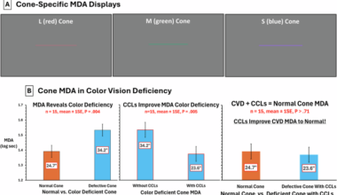 Minimum detectable acuity: Diagnosis of colour deficiency and improvement with colour correcting lenses